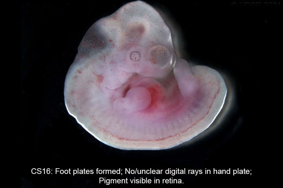 A human embryo, Carnegie Stage 16