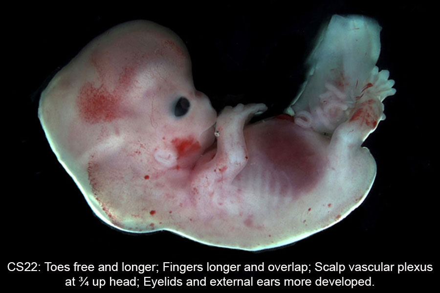A human embryo, Carnegie Stage 22