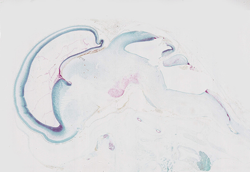 RNAscope data in human fetal brain