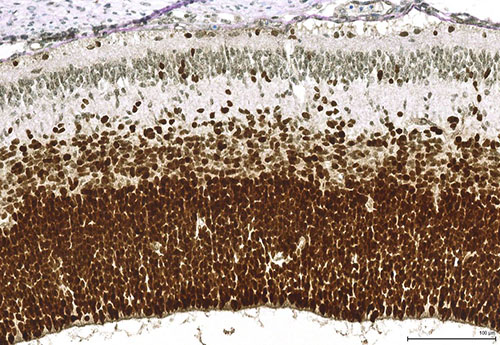 PAX6 immunohistochemistry in human fetal brain