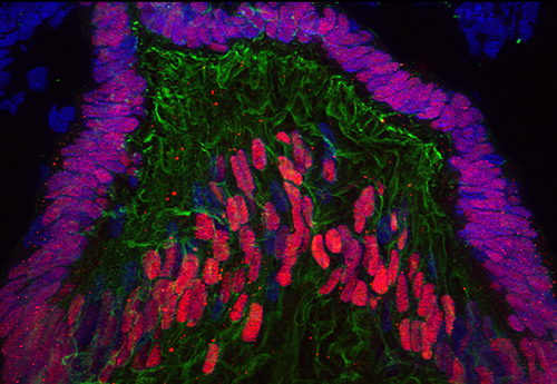 Immunofluorescence in a human embryonic eye