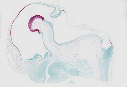 RNAscope data in human embryonic brain