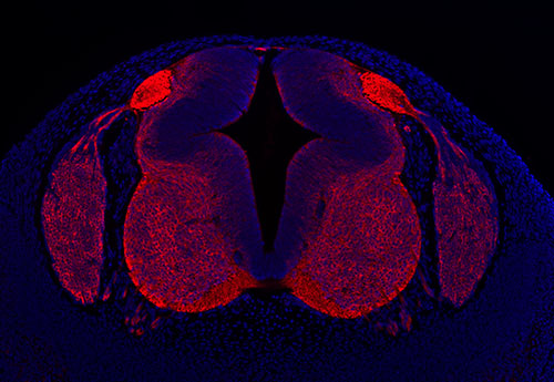 Immunofluorescence in a human embryo