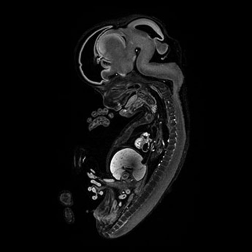 A 3D model of a human fetus