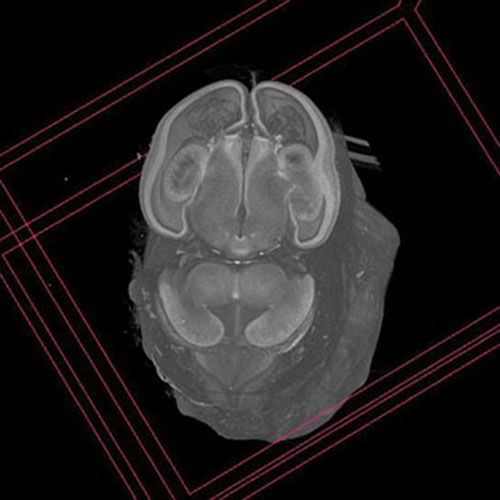 A 3D model of a human fetus