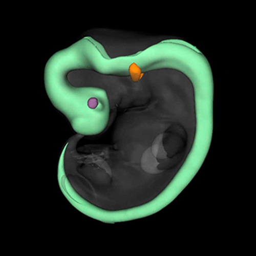 A 3D model of a human embryo