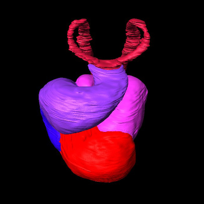 3D model of a human embryonic heart