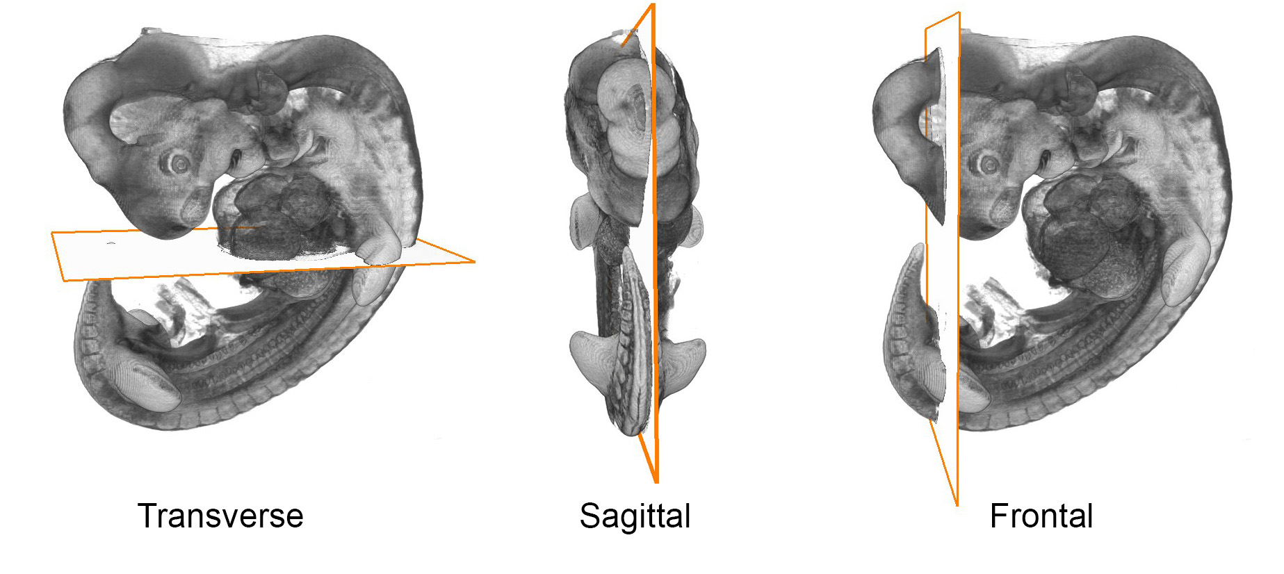 Human embryo sectioning planes