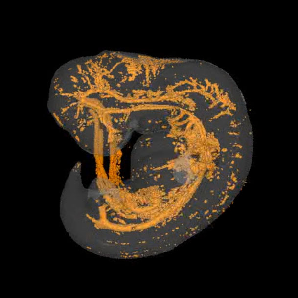 3D model of human embryonic blood vessels