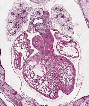 A histology section of a human embryo