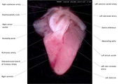 A human fetal heart