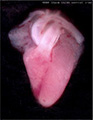A human fetal heart