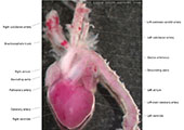 A human fetal heart