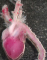 A human fetal heart