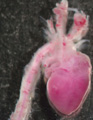 A human fetal heart