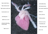 A human fetal heart
