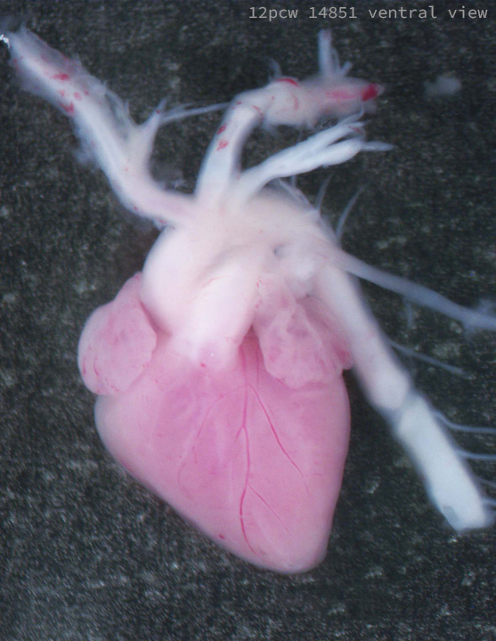 A human fetal heart