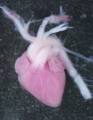 A human fetal heart