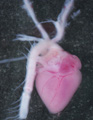 A human fetal heart