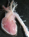 A human fetal heart