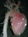 A human fetal heart