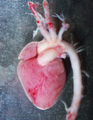 A human fetal heart