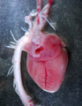 A human fetal heart