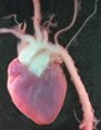 A human fetal heart