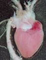 A human fetal heart