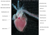 A human fetal heart