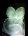 A human embryonic heart