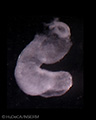 A human embryonic heart