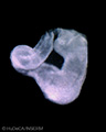 A human embryonic heart