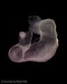 A human embryonic heart