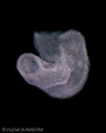 A human embryonic heart