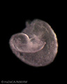 A human embryonic heart