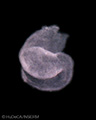 A human embryonic heart
