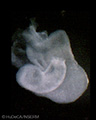 A human embryonic heart