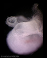 A human embryonic heart