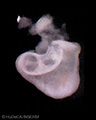 A human embryonic heart