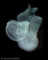 A human embryonic heart