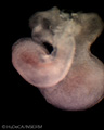 A human embryonic heart