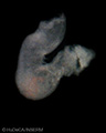 A human embryonic heart
