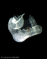 A human embryonic heart