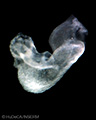 A human embryonic heart