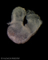 A human embryonic heart