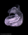A human embryonic heart