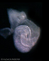 A human embryonic heart