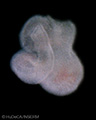 A human embryonic heart