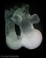 A human embryonic heart